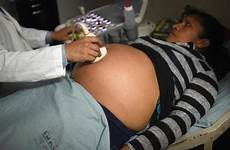 pregnant women pregnancy woman gets ultrasound should guatemala zika afp cdc exposure assessed guatemalan usatoday has ten
