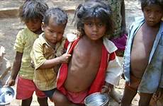 child malnourished malnutrition singh shamed planet three