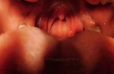 giantess pov mouth vore giantesskatelyn tumblr katelyn endoscope open store ending perfect tooth slave life brooks