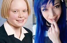 puberty beforeandafter