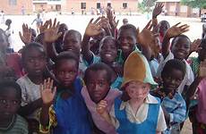 malawi children albino sad front little girl