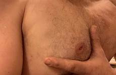 saline breast