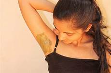 armpits armpit spots rash underarm deodorant