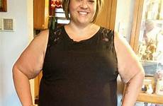 mother obese article launched excess removal fundraising pay campaign try skin she help her