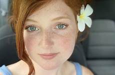 annah freckles redhead redheads freckle girls freckledgirls 9gag natural