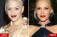 gwen stefani surgery plastic good before after genes now then docs botox doubt lip fillers looks had lips steady blanchett