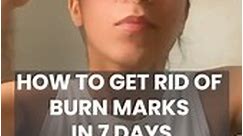 How to get rid of burn marks in 7 days #burnmark #homeremedy #thshealth #glowingskincare Disclaimer - The video is meant for informational purpose. It is not intended to be a substitute for professional medical advice diagnosis or treatment. Contact a physician if you have a medical condition | Thehealthsite.com