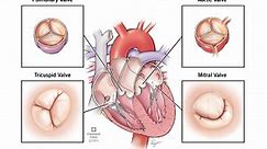 Free Heart Valve Disease Treatment Guide