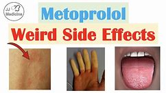 Metoprolol (& Beta Blockers) Weird Side Effects (& Why They Occur)