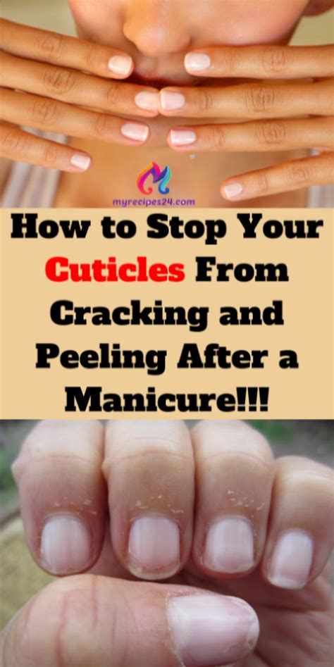 Frustrating with peeling gel nails? How to Stop Your Cuticles From Cracking and Peeling After ...