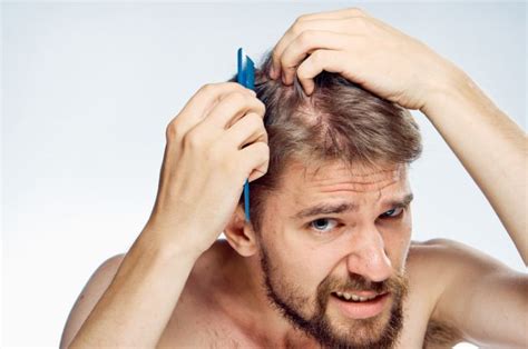 It took me a little off guard, says dr. Can Low Testosterone Cause Hair Loss? - UltraCorePower