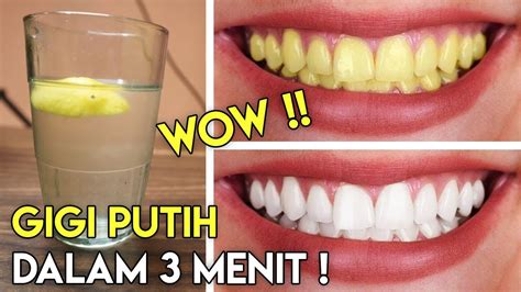 Karena bawang merah memiliki sifat antiseptik dan antimikrobial yang bisa mengendalikan rasa nyeri dengan membunuh bakteri penyebab infeksi. Cara Memutihkan Gigi Dengan Cepat - YouTube