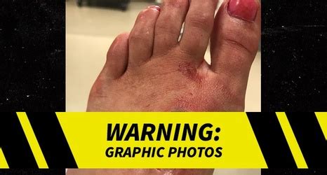 Jun 19, 2021 · i wanted to honour my favourite mma fighter who always leaves his fights very, very bloody. Paige VanZant Rips Bloody Gash In Foot