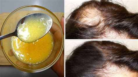 Take the mixture, applying it to your hair and scalp. This Kind Of Egg Shampoo Will Eliminate Hair Loss By 2 ...