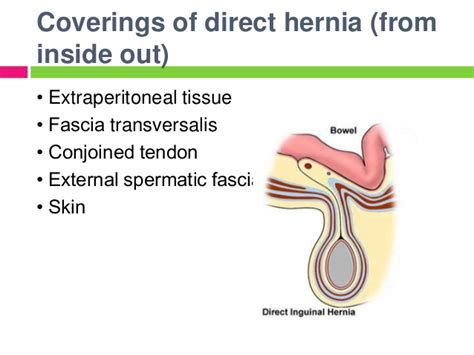  general examination for causes…( Hernia