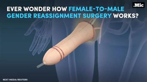Enjoy the videos and music you love, upload original content, and share it all with friends, family, and the world on youtube. Male to female transition surgery pictures ...
