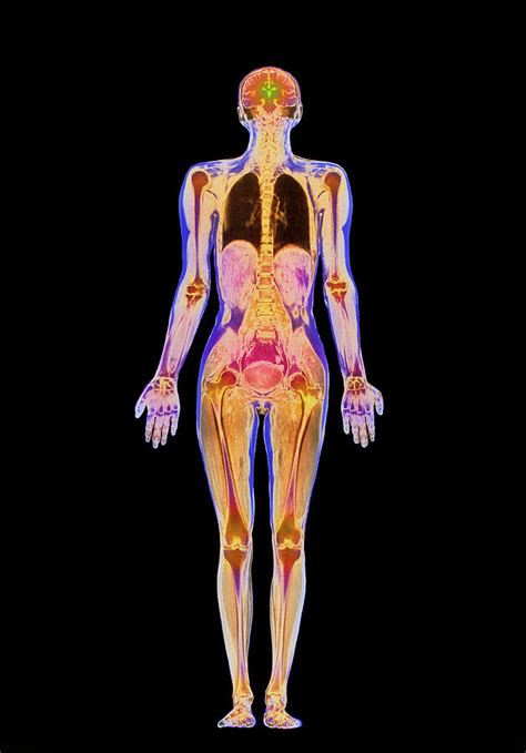 What roles do the digestive, reproductive, and other systems play? Coloured Mri Scan Of A Whole Human Body (female ...