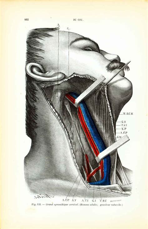 Eye veins, human red blood vessels, blood system. 1897 Vessels Arteries Nerves Neck. Anatomical drawing Human Anatomy Antique Print Surgery ...