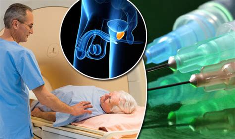 Most men with urinary symptoms do not need to have surgery, but it may be an option if other treatments have not worked. Prostate cancer treatment: New discovery could stop ...