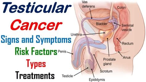 They are located within the scrotum, a loose bag of skin below the penis. Untitled — Testicular Cancer - Signs, Symptoms, Risk ...