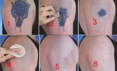 Many factors will determine how long it will take to remove a tattoo. Some Effective Ways to Remove Tattoos Naturally at Home ...