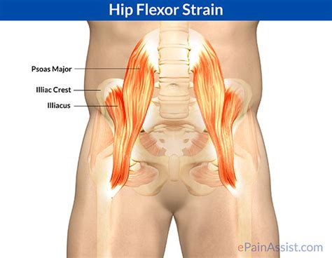 Your hip flexor muscles can be defined as a group of muscles which is sometimes referred to as the iliopsoas (inner hip muscles). An annoying, nagging, pain for runners. - Empire Unleashed