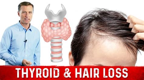 Medications such as minoxidil may help to promote the growth of new, healthy hair. The Ketogenic Diet, Your Thyroid and Hair Loss - YouTube