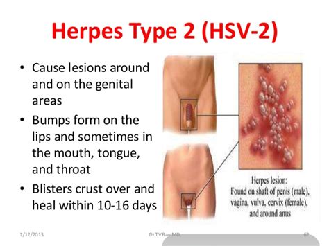 Herpes simplex | manbir online ~ for health & fitness from manbironline.files.wordpress.com. Sexually transmitted infections