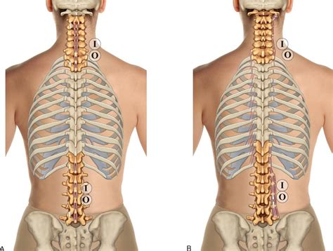 Proper anatomical name for muscles around rib cage / intercostal neuralgia. Proper Anatomical Name For Muscles Around Rib Cage / 8 Muscles Of The Spine And Rib Cage ...