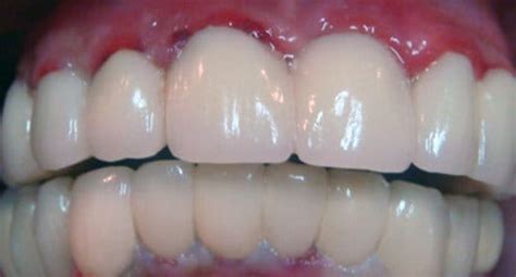 Here are 5 natural ways to soothe swollen gums and get your mouth feeling better. Common Oral Health Symptoms You Shouldn't Be Ignoring ...