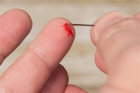 In general, a plant that is not under significant stress can wait out a mite infestation; How to Remove a Piece of Glass from a Finger (with ...