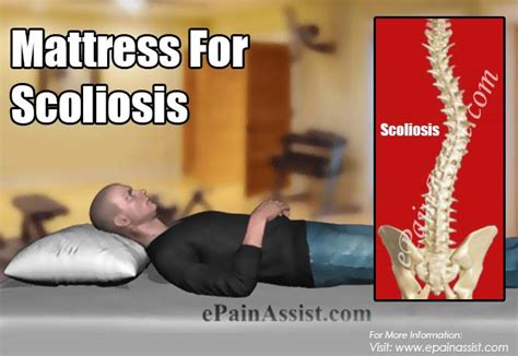 However, again this depends on the sleeping positions most comfortable. Mattress For Scoliosis: Is Firm or Soft Mattress Good for ...