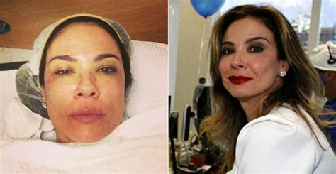See more of luciana gimenez on facebook. Sem maquiagem, Luciana Gimenez faz procedimento estético e mostra na web | CARAS