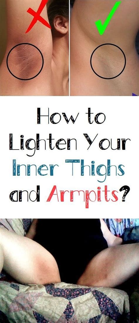 See more ideas about dark underarms, dark armpits, lighten armpits. How to Lighten Your Inner Thighs and Armpits? | Lighten ...