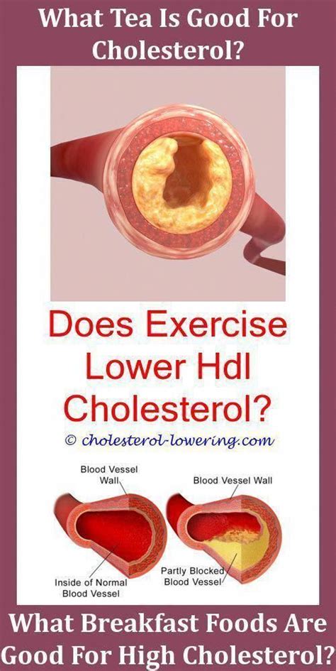 Elevated ldl and low hdl cholesterol levels increases your risk of heart attack, stroke how have you lowered your ldl (bad) and raised your hdl (good) cholesterol numbers? Cholesterollevels What Should My Cholesterol Be For My Age ...