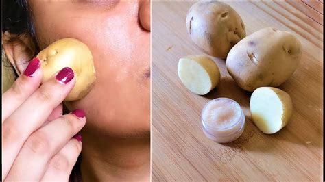 Luckily, raw potatoes are still pretty hearty and will last for weeks in most households. Do this for 10 minutes Every Night & change your skin ...