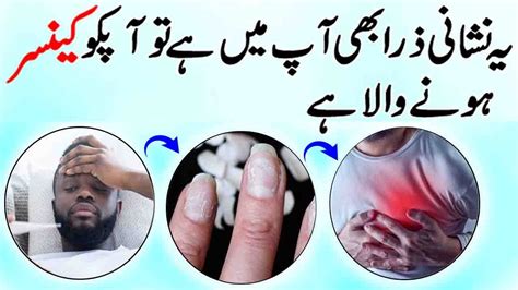 And because early detection is crucial in overcoming this disease, you'll want to visit your doctor immediately if any of the following symptoms persist for more than two weeks: How to Identify Cancer Signs and Symptoms in URDU HINDI ...