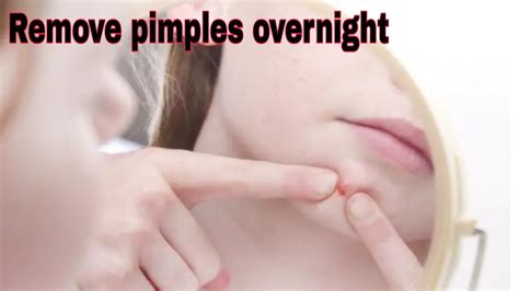 How to get rid of scars on vag. how to remove pimples overnight / how to get rid of acne ...