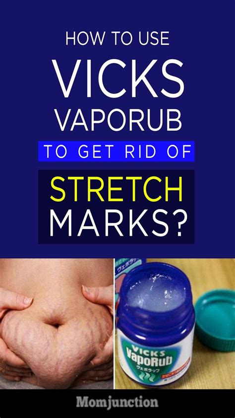 Spider veins are the result of engorged veins and increased pressure. How To Use Vicks VapoRub To Get Rid Of Stretch Marks ...