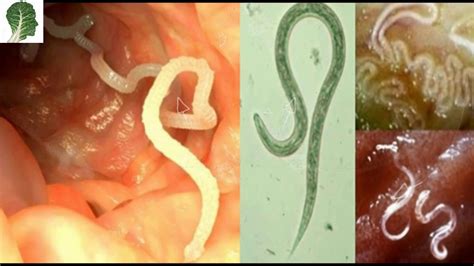 Baking soda is an essential ingredient that everyone should keep it in the home due to its huge range of different applications (health, beauty, and home). 7 Herbs That Treat Internal Parasites Fast | Parasite ...