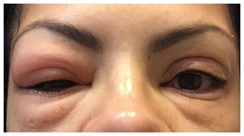 How do i removed my eyelash extensions? How To Remove False EyeLash Extensions (AT HOME) # ...