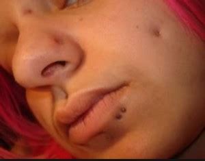 An indent in someone's cheek. Dimple Piercing Scars - Pictures of Cheek, Back Dimple ...