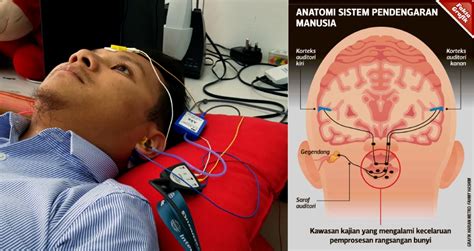 Punca kenapa telinga berdesing #3. Rawat gangguan halusinasi | Harian Metro