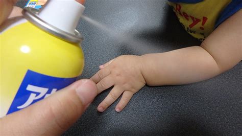 子どものあせもに即効性ある市販薬は？アトピーっ子のかゆみ ...