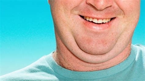 Ternyata double chin juga dapat disebabkan karena penyakit tertentu serta cara pengobatan penyakit tersebut. Cara Alami Hilangkan Double Chin (Dagu Berlapis) - Blog Unik