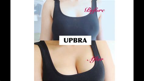 Ich wünsche euch ganz viel spaß bei diesem video. MEINE BRUST OP OHNE OP "UPBRA" | JENNYFROMTHEBLOG - YouTube