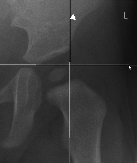 (los navegadores en la mayoría de los probation and pretrial services electronic reporting system. Radiographic assessment of developmental dysplasia of the ...