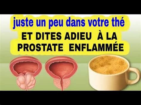 DITES ADIEU À LA PROSTATE ENFLAMMÉE Comment dégonfler la prostate ...