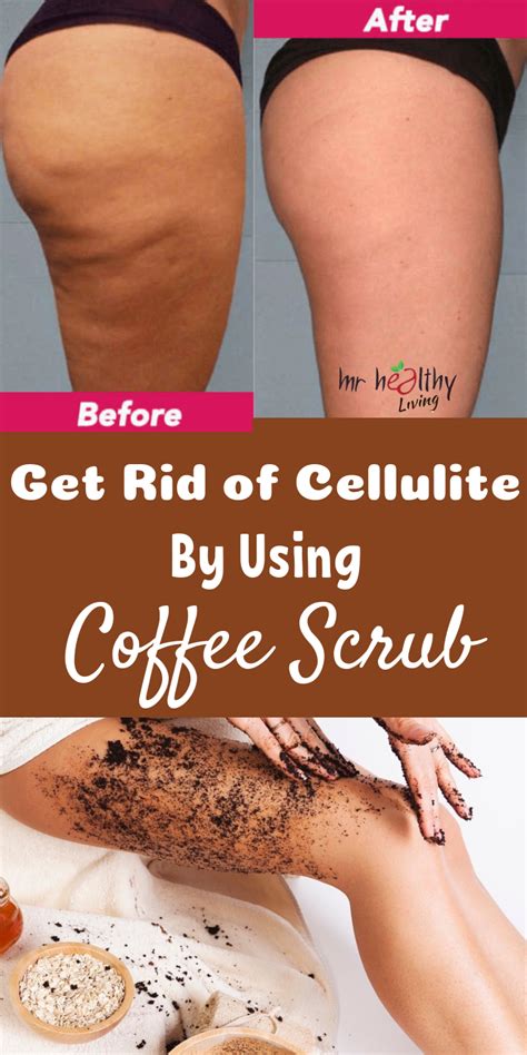 This article is for everyone who is troubled with cellulite and now it's seems to be the perfect time to start dealing with it. Pin on Coffee Scrub Homemade