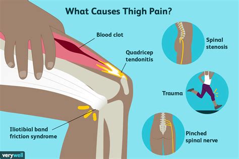 What are the functions of the skeletal and muscular systems? thigh pain hip replacement - Joint Pain Clinic